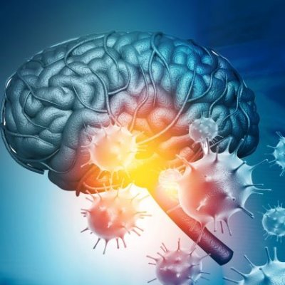 A graphic showing a brain in blue with viruses in red 'infecting' it and lighting it up against a medical background.
